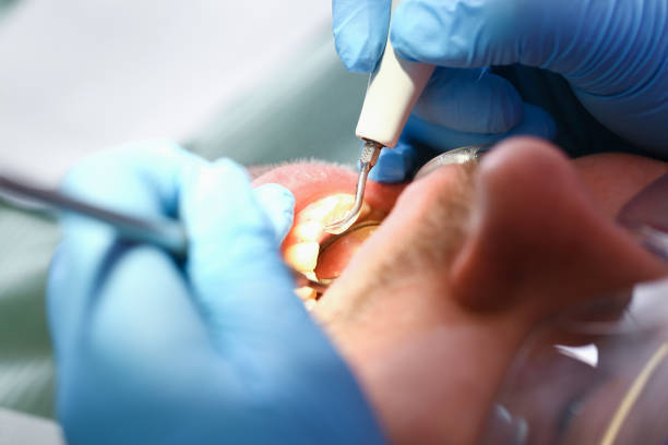 Best Emergency Cosmetic Dentistry (e.g., broken veneers) in Holloman Af, NM